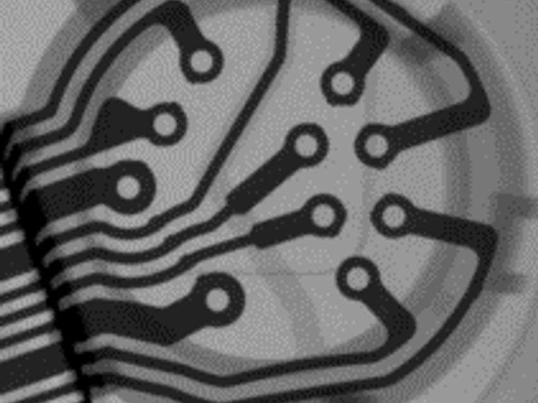 Component X-ray inspection